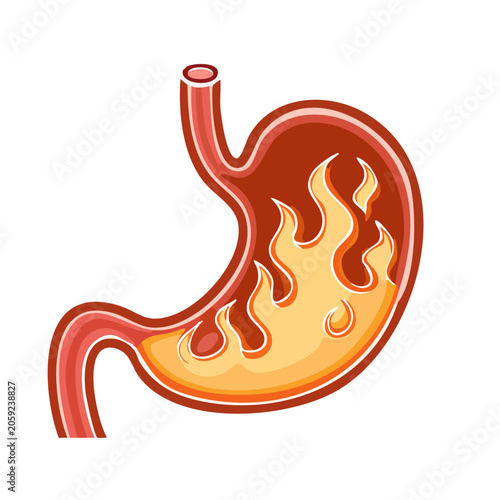 Stomach with flames illustration