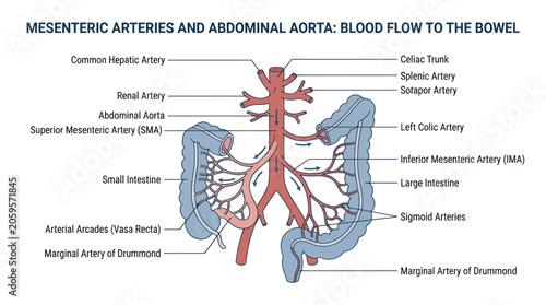 Tableau sur toile Mesenteric arteries and abdominal aorta blood flow to the bowel