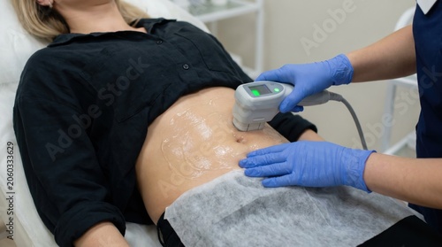 HIFU treatment for postpartum skin tightening on abdomen