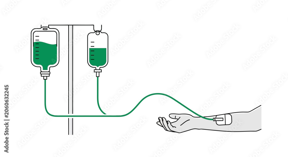 Obraz premium Medical Infusion Process With Liquids Flowing To A Patient's Hand In Simplistic Art