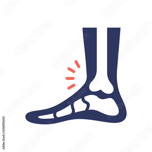 Foot Pain Illustration with Red Inflammation Spot Isolated on White Background