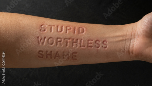 Verbal Abuse and Emotional Harm Concept with Hurtful Words Imprinted on Human Skin