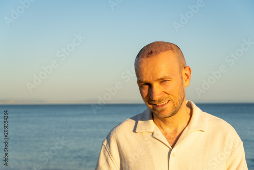 Portrait of a happy, smiling Caucasian man displaying his healing scalp with scabs after a recent hair transplant procedure, standing outdoors against the ocean at sunset