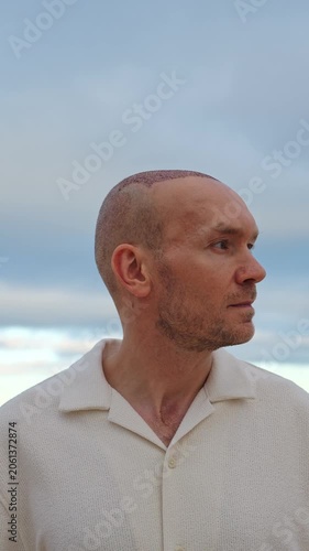 Portrait of a happy, gently smiling Caucasian middle-aged man displaying his healing scalp with scabs after hair transplant procedure, standing outdoors against overcast clouds view. Vertical Video