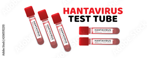 Fotografía Hantavirus Disease (Hantaviruses) – Rodent-Borne Viral Infection, Symptoms, Prev
