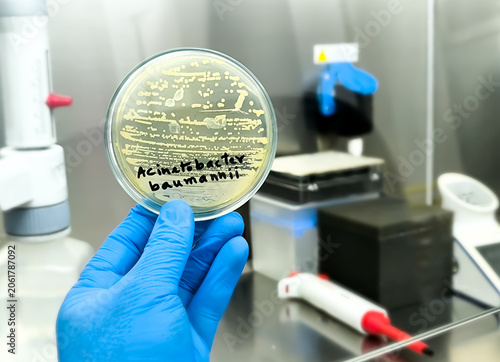 Microbiologist holding petri dish with bacterial collony of Acinetobacter Spp. Acinetobacter baumannii