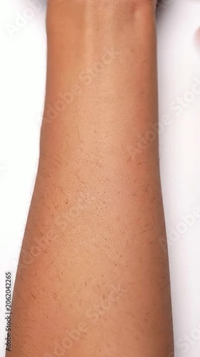 Close-Up Detailed Arm Skin Texture Showing Follicles and Pores for Medical and Dermatology Concepts On Plain White Background