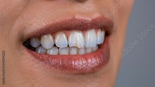 Close up of a person's mouth showing cracked and chipped front teeth with inflamed gums, dental issues, cosmetic imperfections, health concerns