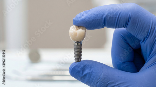 Extreme Close-Up of Dentist Hand Holding Dental Implant with Ceramic Crown, Minimalist Concept of Prosthodontics, Stomatology and Tooth Restoration