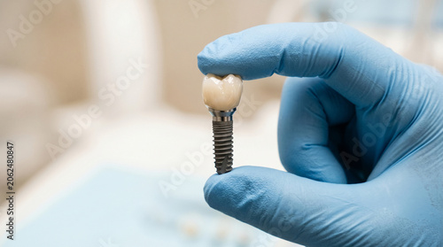 Extreme Close-Up of Dentist Hand Holding Dental Implant with Ceramic Crown, Minimalist Concept of Prosthodontics, Stomatology and Tooth Restoration
