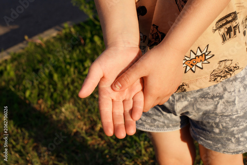 Fotografía Close up photo of little child showing growing back fingernail after painful fin