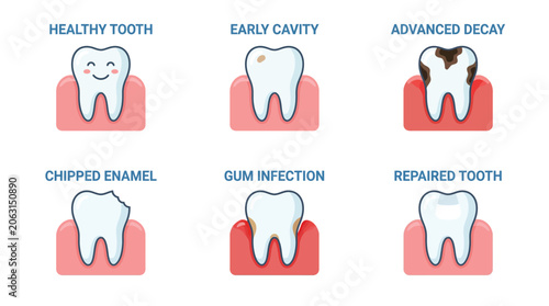 Tooth pain infographic detailing tooth decay cavity progress and gum inflammation