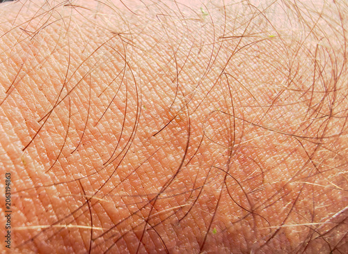 Close view of skin showing hair strands and texture on an arm in natural light during the day
