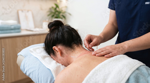 A young Asian woman receives acupuncture treatment on her back. A practitioner inserts a needle into her skin in a calm, modern clinic setting.