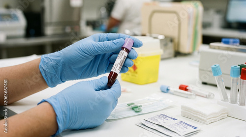 Photos Professional Blood Sample Processing for Clinical Laboratory Diagnostics