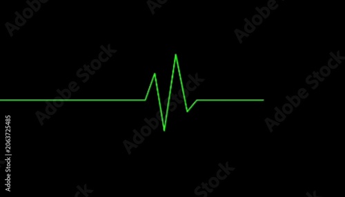 EKG Heartbeat Pulse