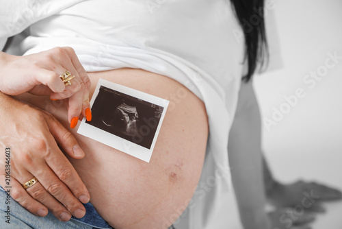 Expecting Couple Holding Ultrasound Scan Photo on Pregnant Belly