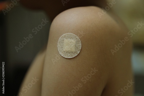 Bandage Covers the Vaccine Injection Site on the Child's Arm
