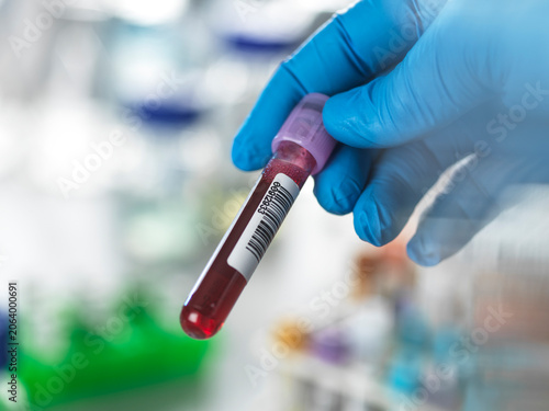Gloved hand holding a blood sample vial with a barcode in a laboratory setting.