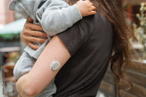 Close-up of a continuous glucose monitor CGM sensor on a mother's arm as she hugging her little toddler son outdoors.