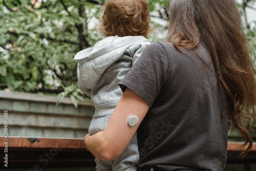 Close-up of a mother from behind holding her curly-haired toddler son, showing a continuous glucose monitor CGM sensor on her arm.