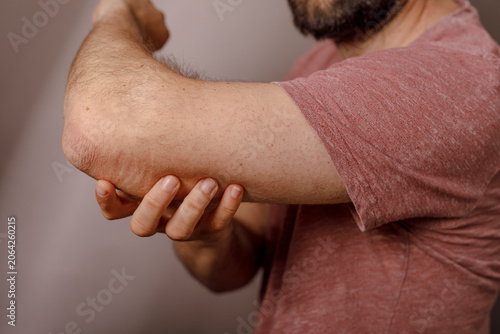 Bild auf Leinwand Close up of a man holding his elbow in pain, discomfort and medical condition
