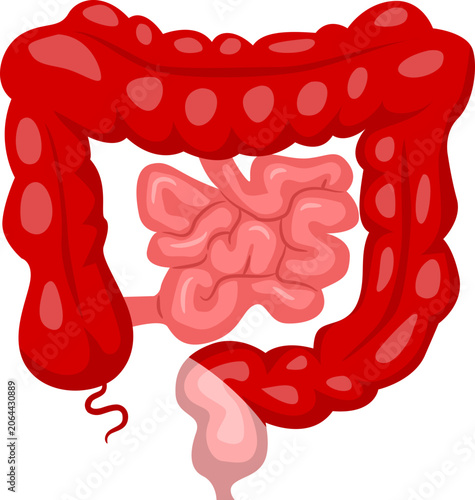 Photos Bowel Surgery total abdominal colectomy