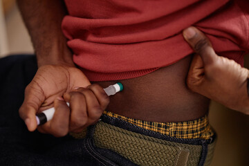 Close up of Black man injecting insulin into abdomen, managing diabetes with self care routine at home. Ideal for healthcare campaigns, chronic disease treatment, patient education