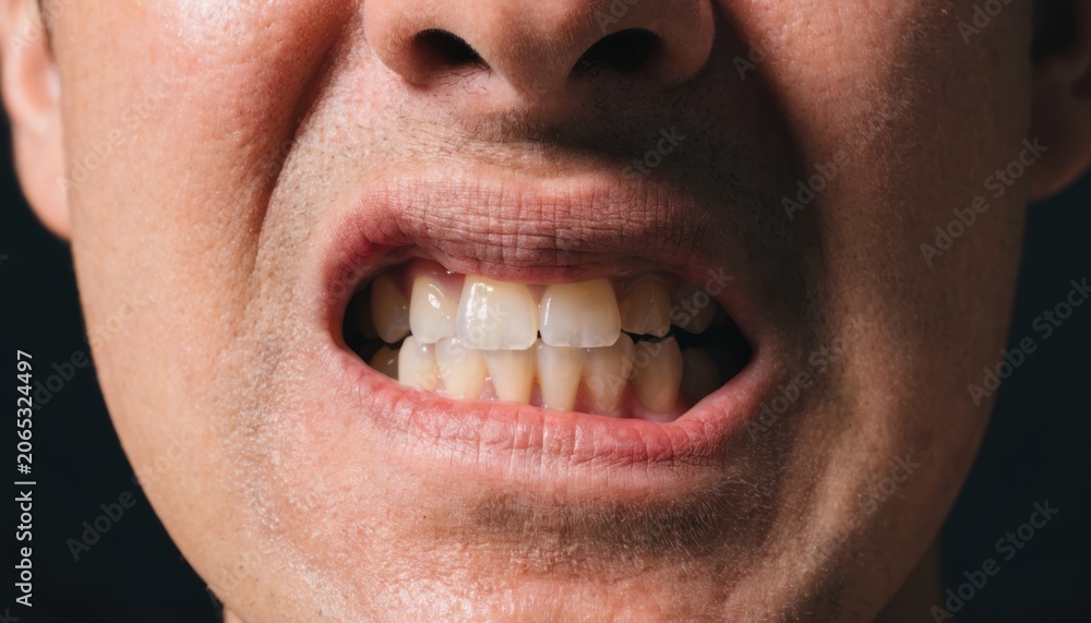 Fototapeta premium Close-up of a person's mouth showing yellowed, misaligned teeth and dry lips against a dark background.