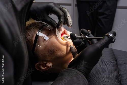Fotografie Dentist in black gloves administering a local anesthetic injection to a patient'