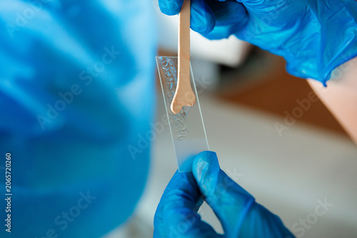 Close-up of cervical sample being smeared on glass slide