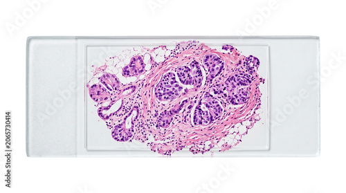 Obraz na plátne Microscopic view of biological glandular tissue sample on slide