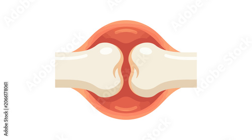 Obraz na plátne Red Inflamed Joint Showing Rheumatoid Arthritis