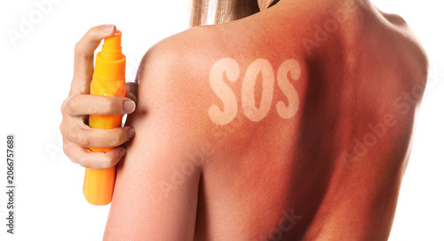 Foto Woman with red sunburned skin applying after-sun product against white backgroun