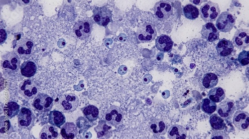Blood Parasite Thick Film Giemsa Stained Microscope Slide