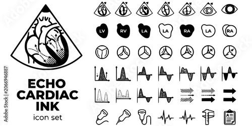 Bild auf Leinwand Cardiac Echo Ultrasound Ink Black White-Chamber Valve Doppler Flow-Cardiac Imagi