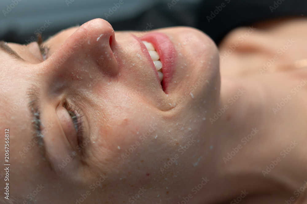 Naklejka premium Close-up of a young woman's face after a peeling procedure. Exfoliated dead skin cells, epidermis renewal, deep cleansing, professional skincare and healthy glowing skin concept.