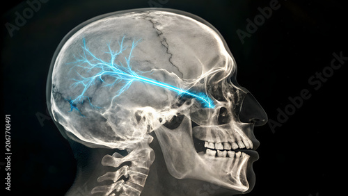 x ray image of human skull