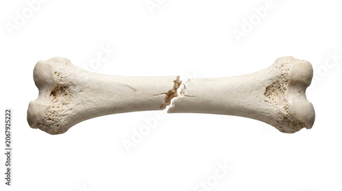 Foto Single human bone in middle broken, isolated on transparent background with soft shadows