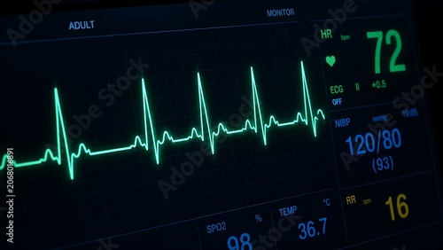 Medical Patient Monitor Screen with ECG Heartbeat Waveform and Vital Signs Display