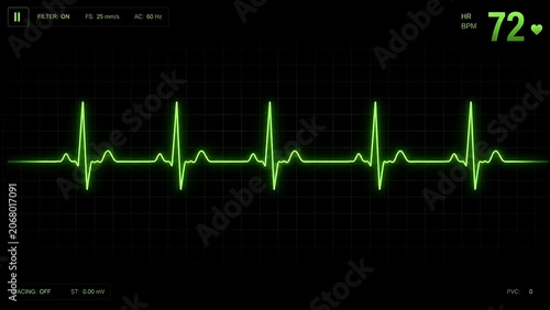 Neon ECG Heartbeat Waveform on Medical Monitor Screen with Heart Rate 72 BPM