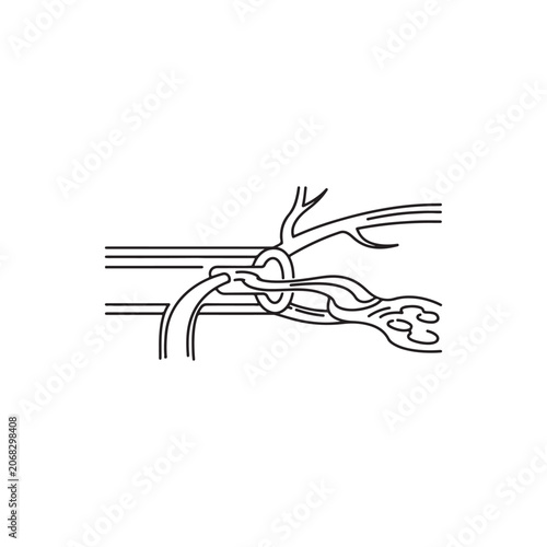 Medical illustration of blood flow in artery obstruction line art icon set.