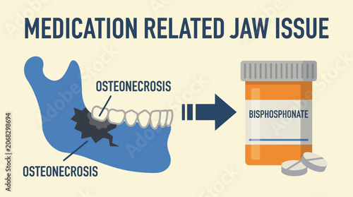 Foto Osteonecrosis Jaw Bisphosphonate Medication Related