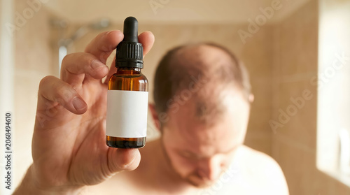 Baldness treatment dropper bottle man scalp hair loss serum bathroom care routine for thinning hair and hopeful regrowth support