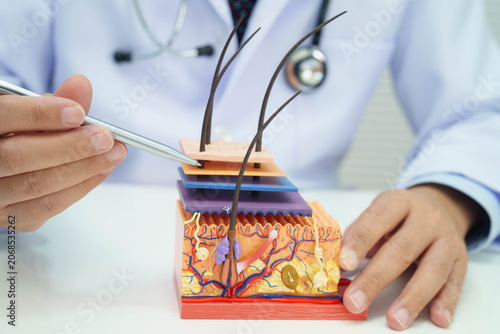 Hair transplant, Asian dermatologist doctor holding skin structure anatomy model for treatment in hospital.