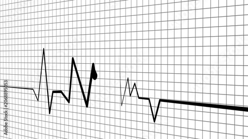 Zigzag line sharp rise and fall suggesting data heart rhythm wave pulse animation
