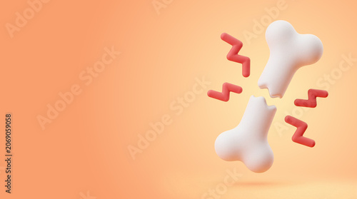 3D render of a broken white bone with red pain symbols on orange background