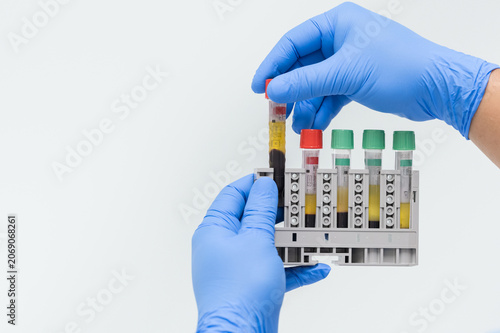 Doctor hand holding blood test tube on white background for laboratory analysis.Sicientist wear blue gloved hands prepearing blood sample at clinic laboratory.Laboratory, exam and scientist.