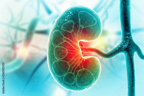 Chronic Kidney Disease. Medical organ. Cross section. 3d illustration