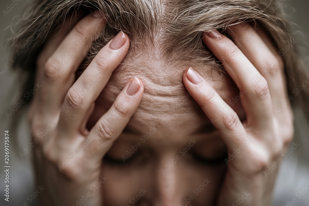 Fototapeta premium Close-up of a woman's face with hands on her forehead, showing stress and worry lines.